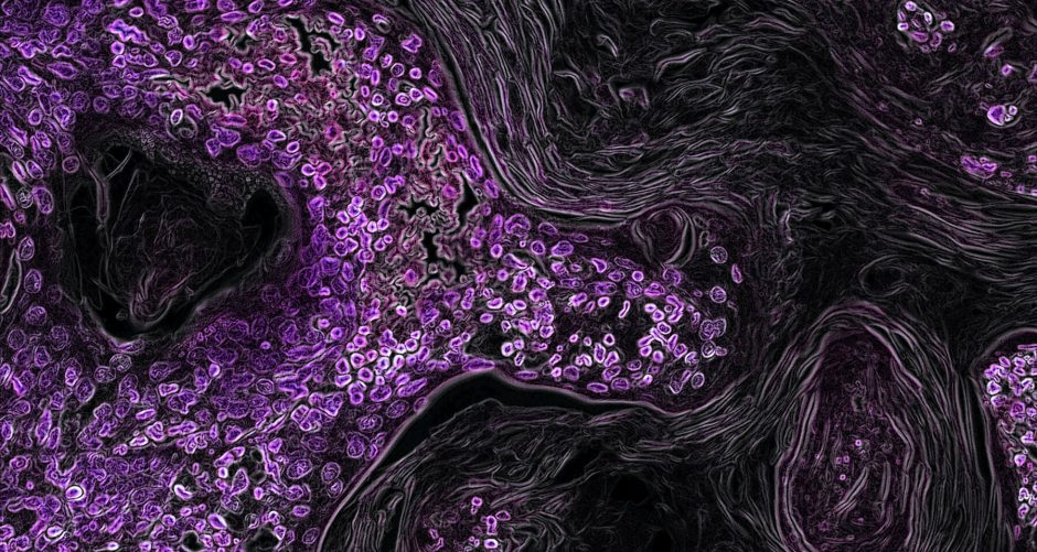 Magnified image of a stream of purple cells.