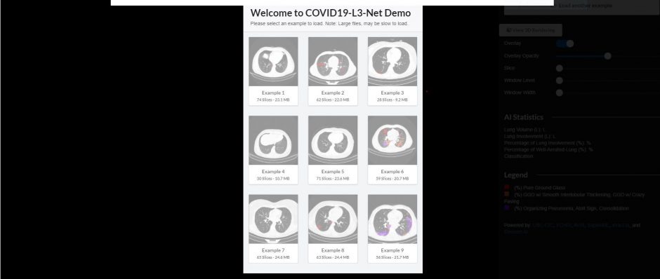 A picture of the COVID19-L3-Net Demo page where user can select an example scan to load.