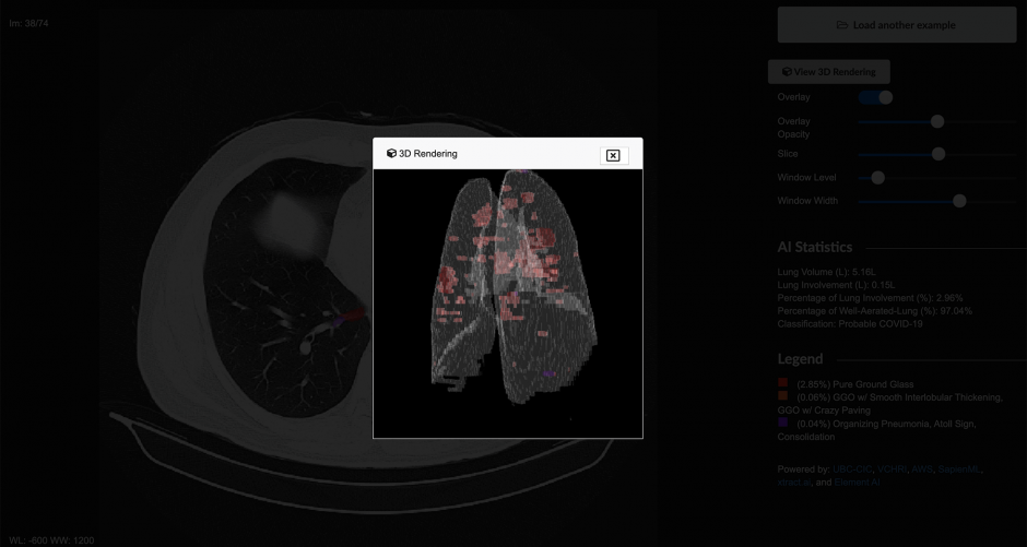 A popped up image of a lung diagram with red highlights.