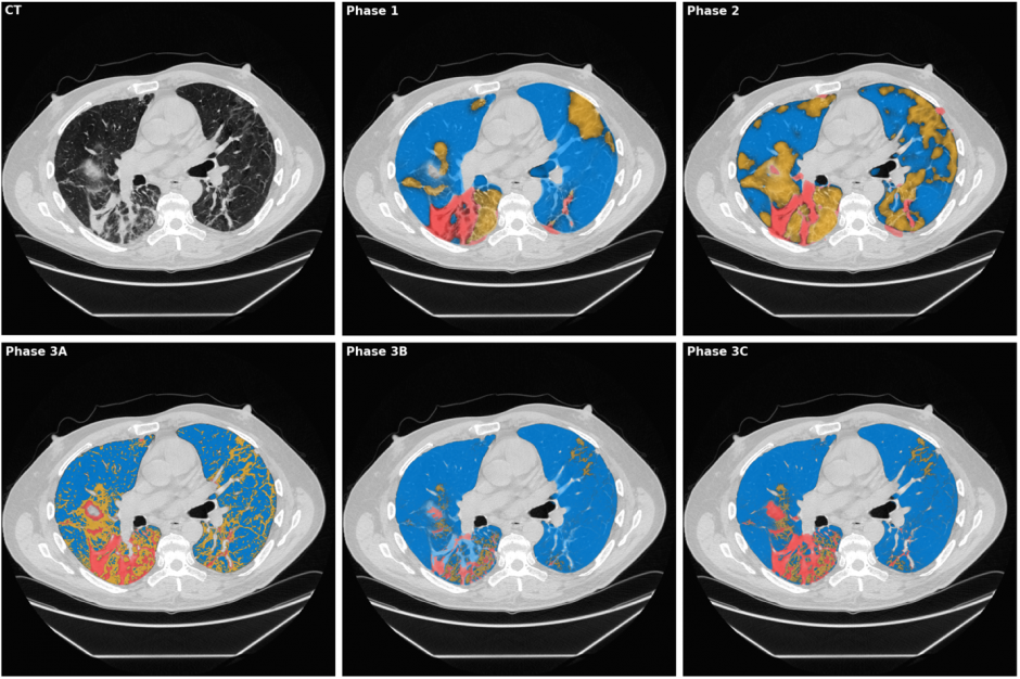 A picture of 6 variations of CT scans.