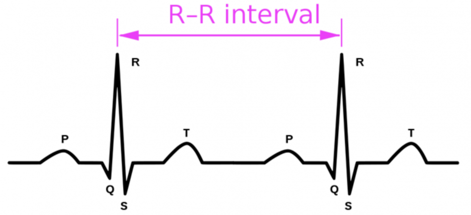 Figure 2 shows the QRS complex. The image shows the beginning of a systole and ventricular contraction. The R-R interval label describes the space between two systole and ventricular contraction.